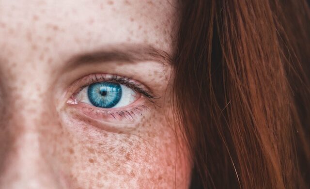 eye of a redhaired woman dominant ayurvedic dosha